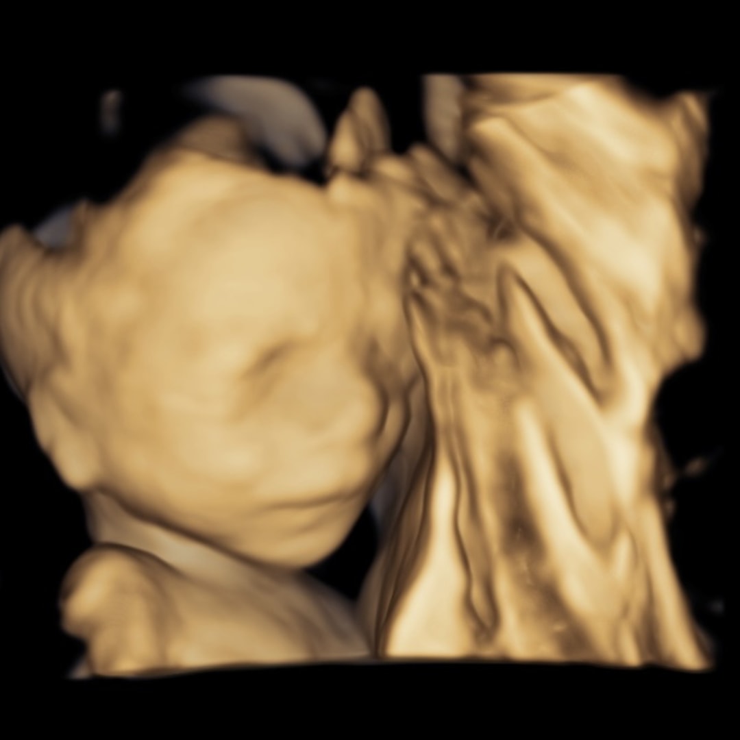 Photo shared by Anna for their Babylist baby registry.
