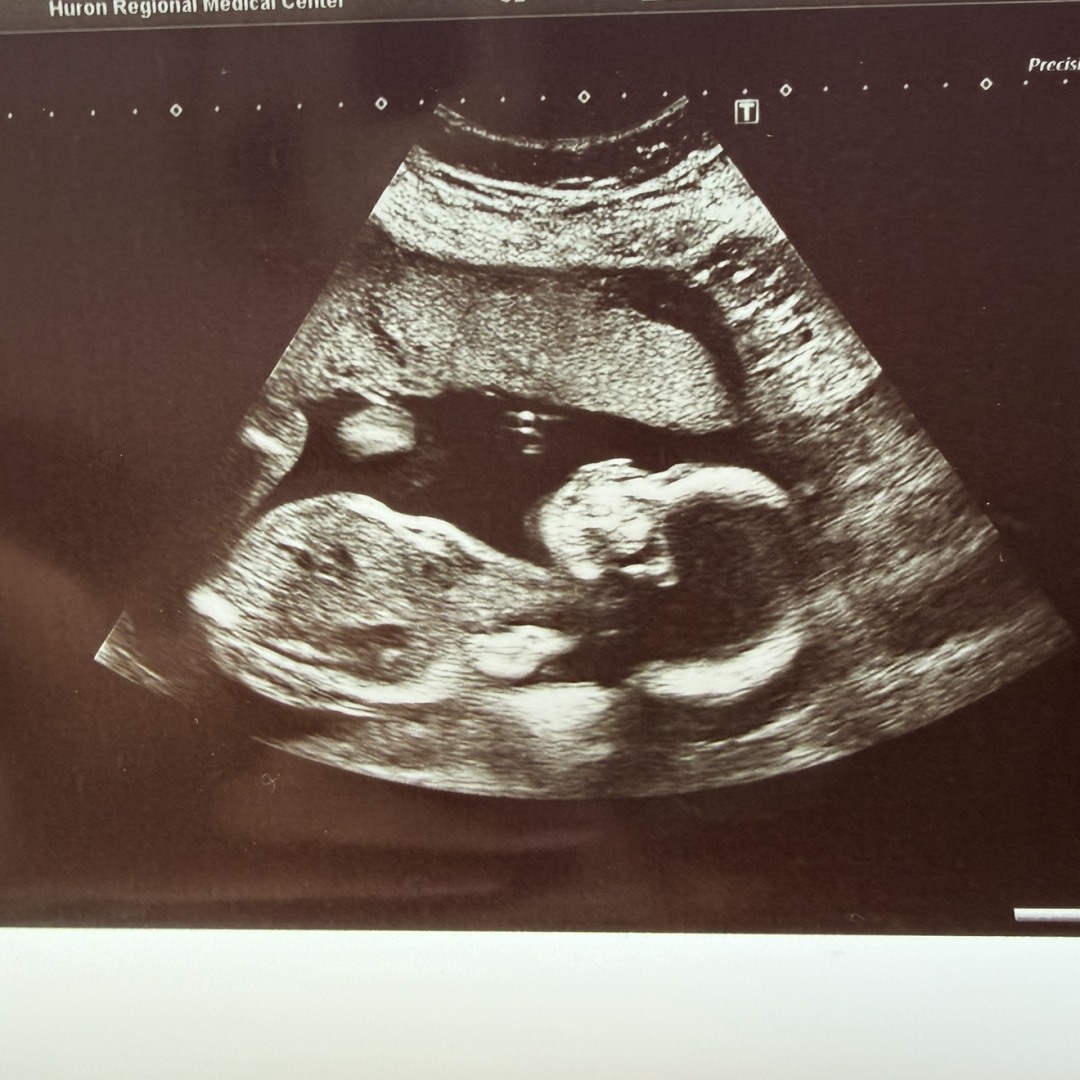 Photo shared by Ondrea for their Babylist baby registry.