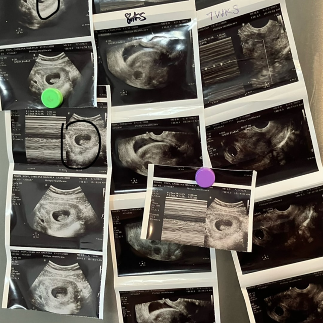 Photo shared by Cassy for their Babylist baby registry.