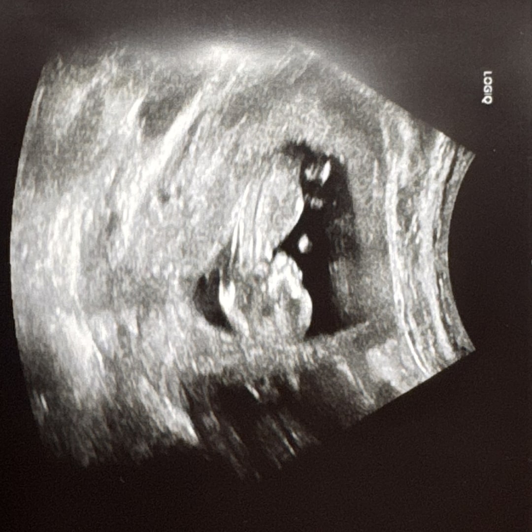 Photo shared by Tiffany for their Babylist baby registry.