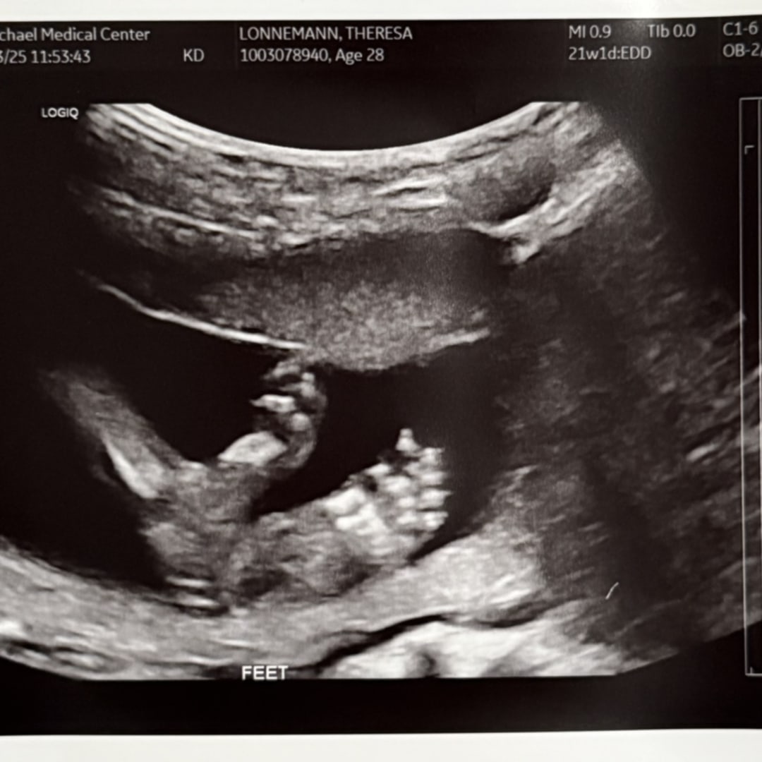 Photo shared by Theresa for their Babylist baby registry.