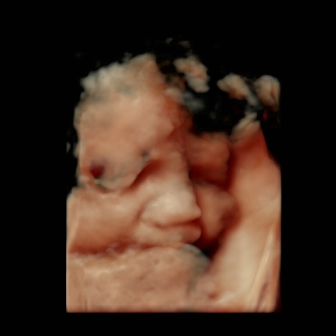 Photo shared by Kristine for their Babylist baby registry.