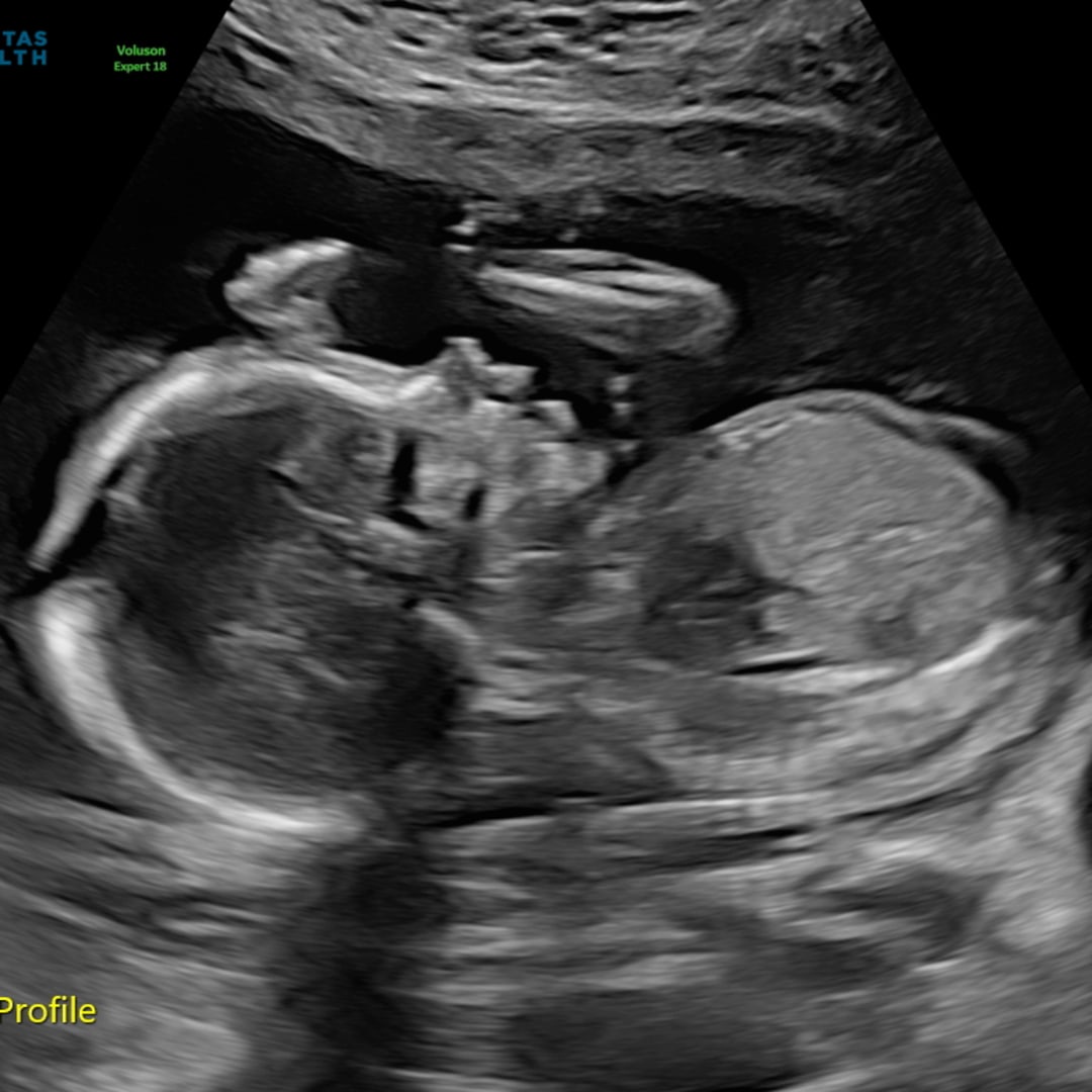 Photo shared by Kendall for their Babylist baby registry.