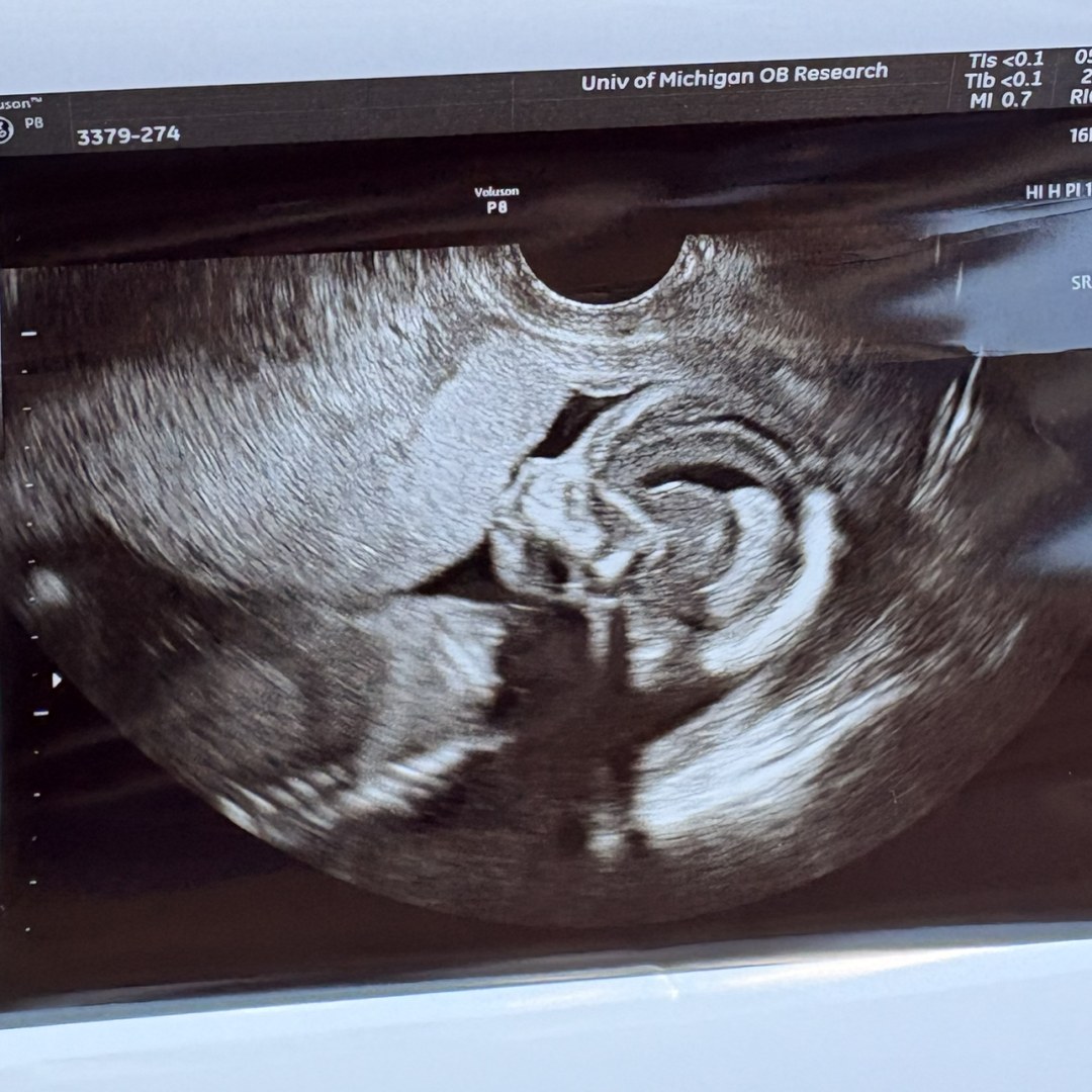 Photo shared by Grace for their Babylist baby registry.