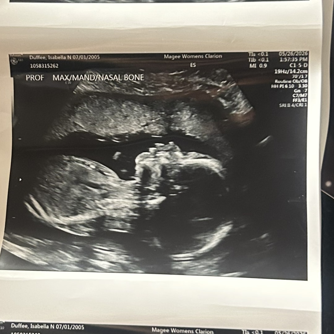 Photo shared by Isabella for their Babylist baby registry.