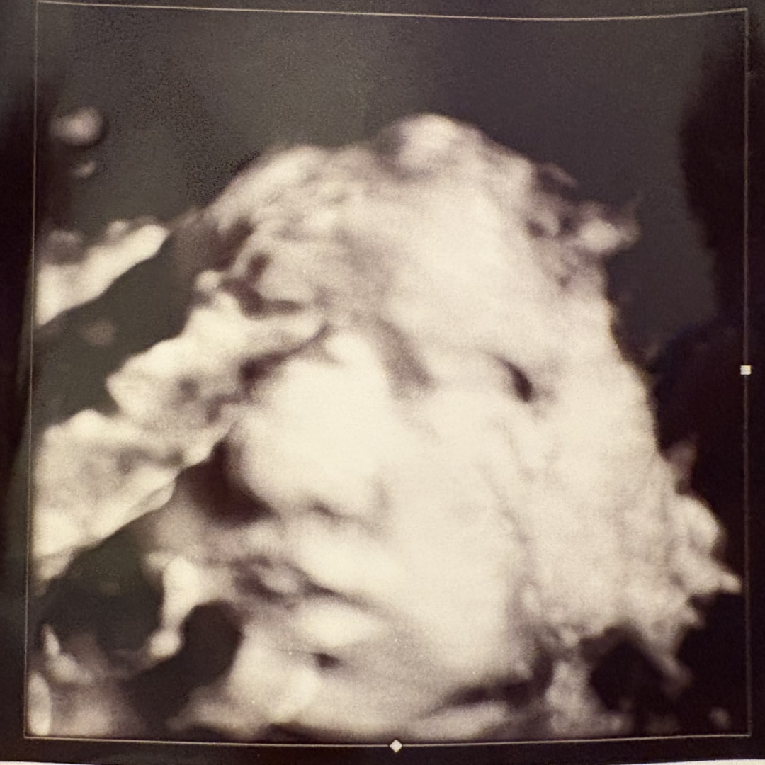 Photo shared by Jessica for their Babylist baby registry.