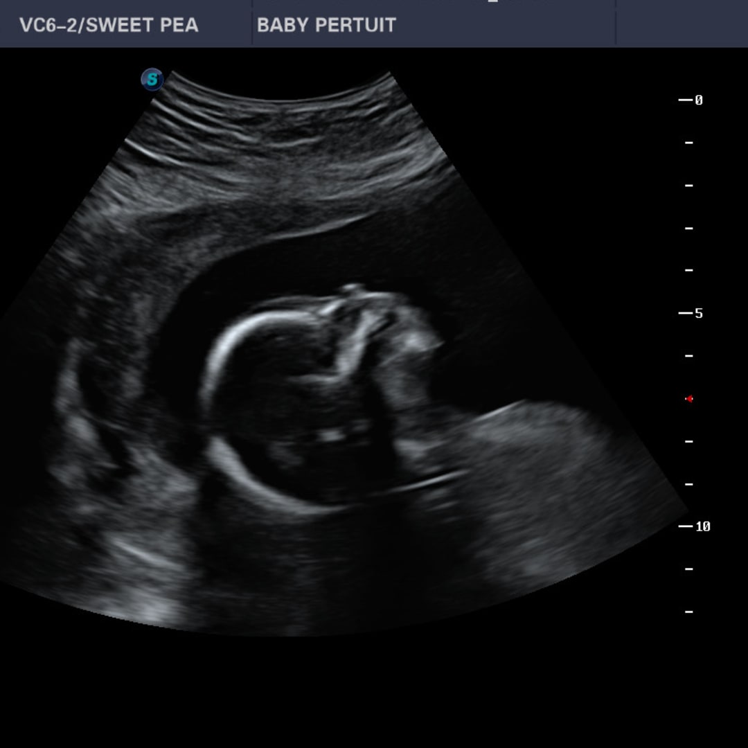 Photo shared by Vania for their Babylist baby registry.