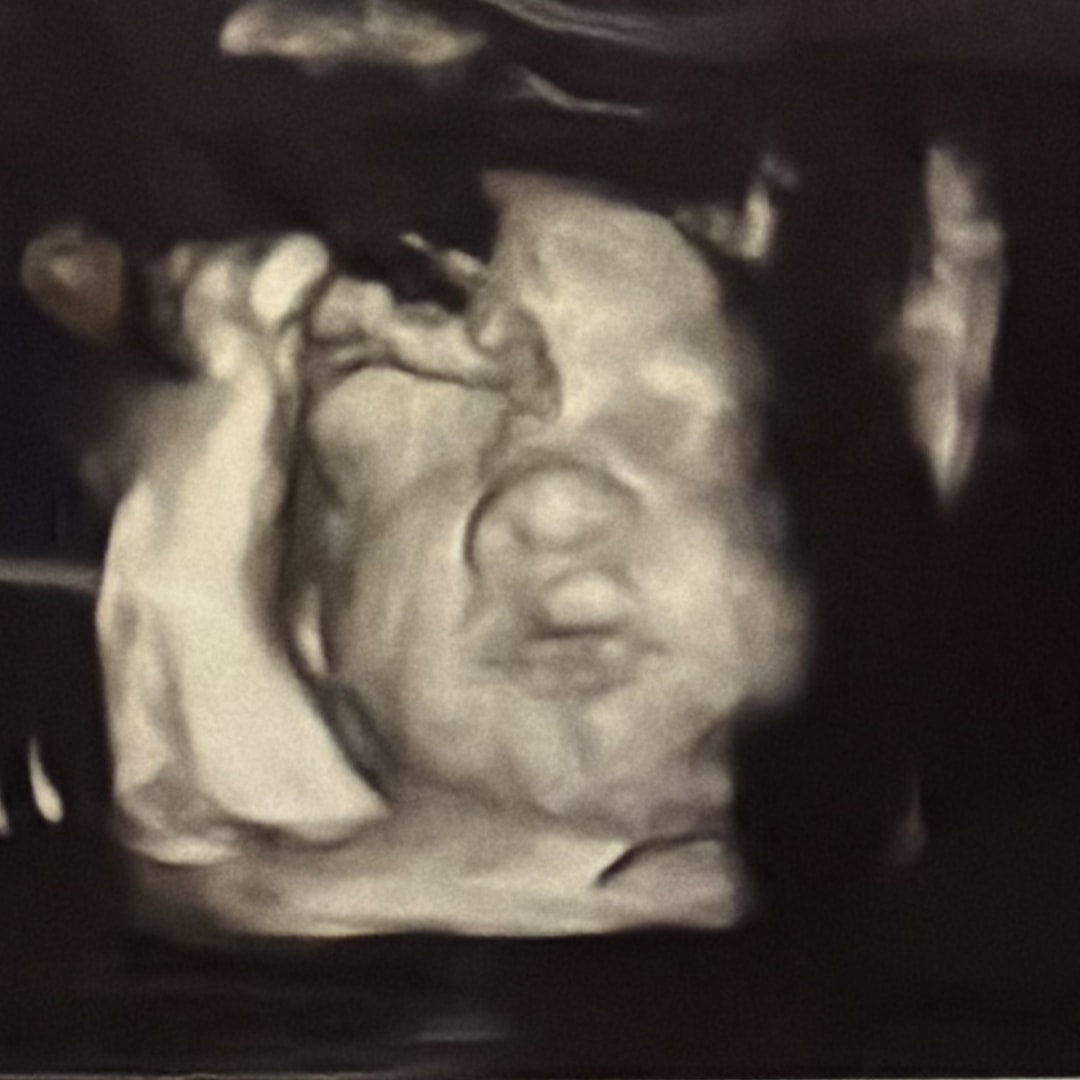 Photo shared by Khya for their Babylist baby registry.