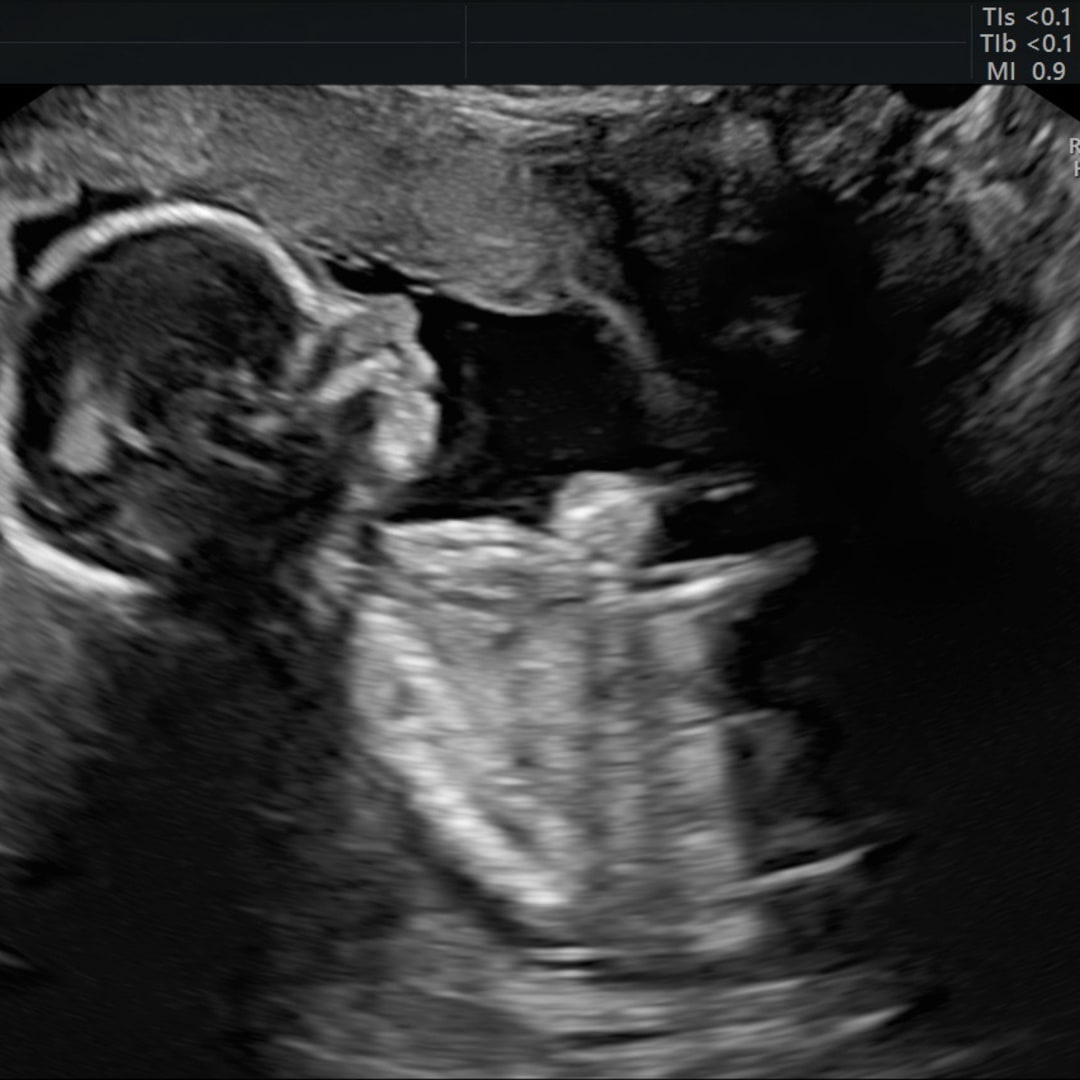 Photo shared by Brooke for their Babylist baby registry.