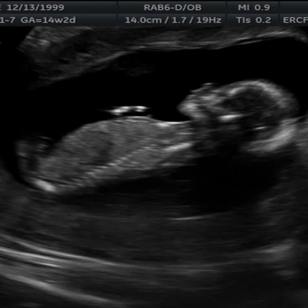 Photo shared by Kaylee for their Babylist baby registry.