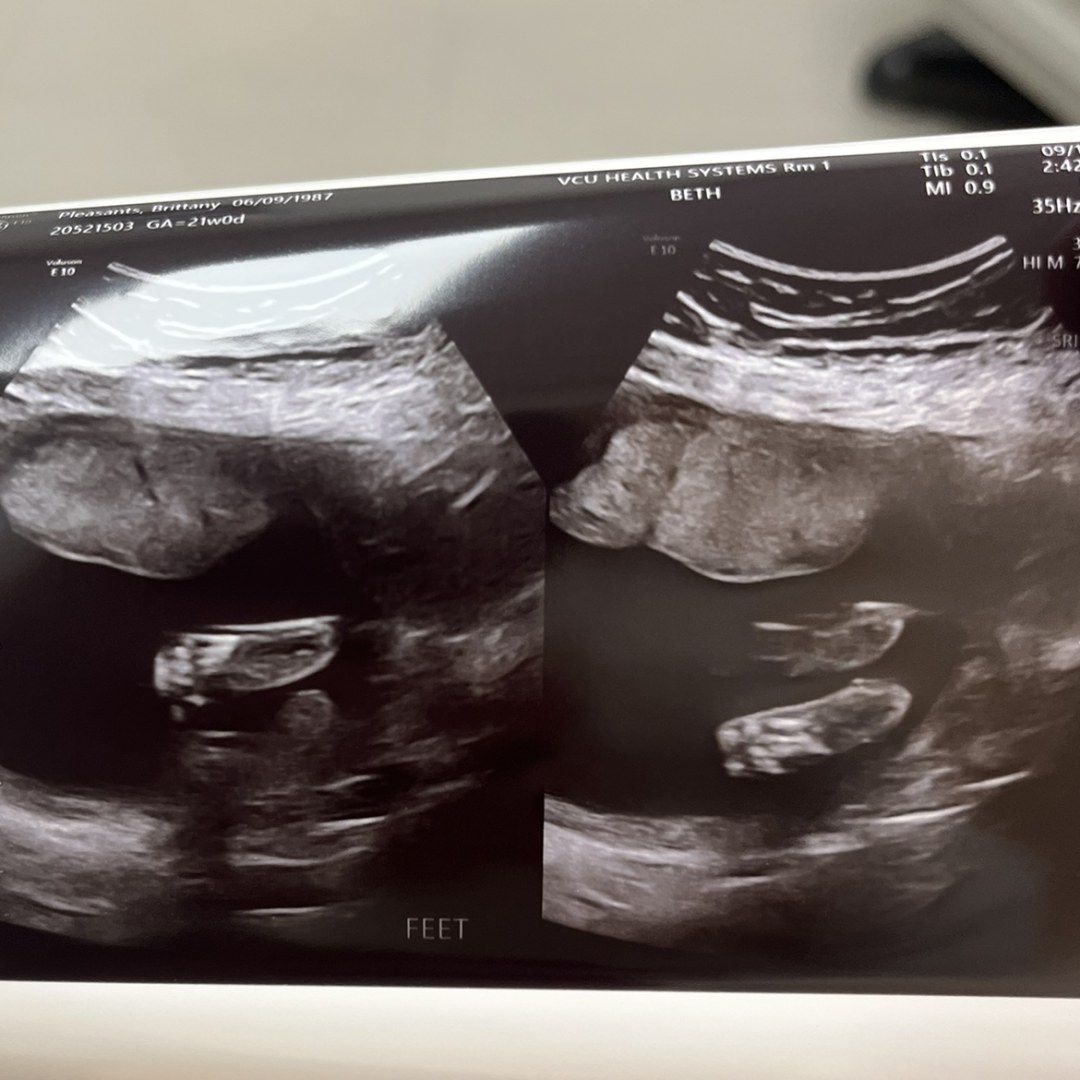Photo shared by Brittany for their Babylist baby registry.