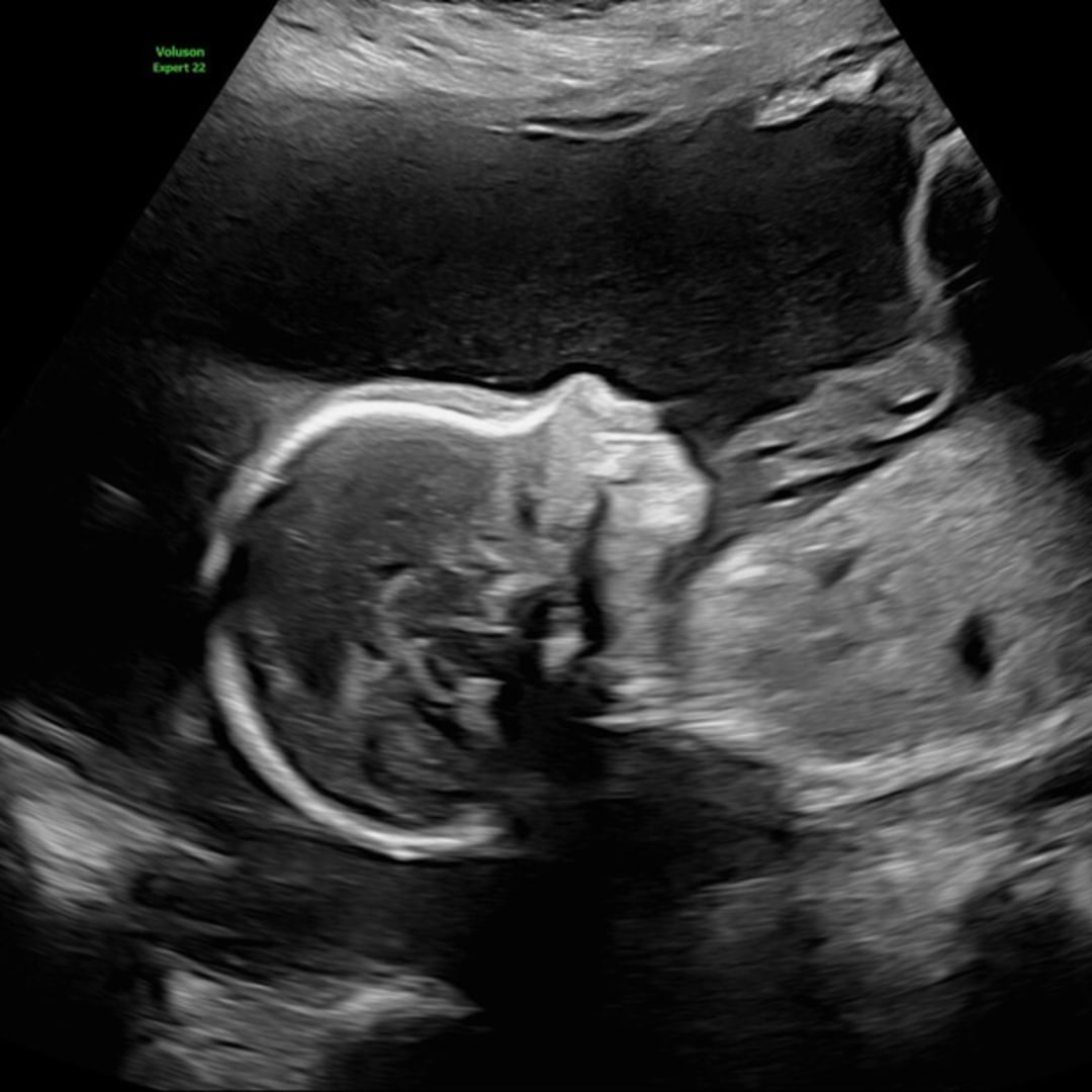 Photo shared by Heidi for their Babylist baby registry.