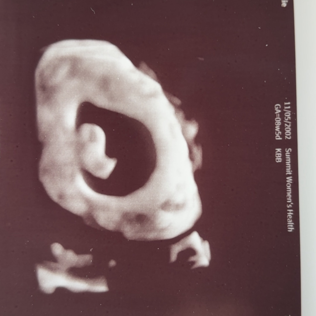 Photo shared by Carlie for their Babylist baby registry.