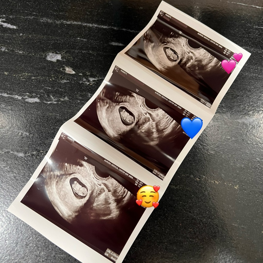Photo shared by Morgan for their Babylist baby registry.