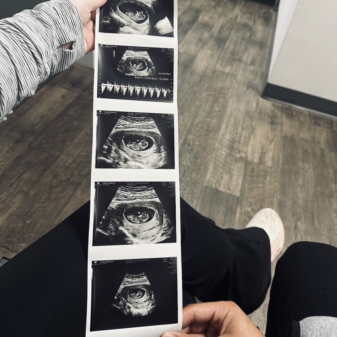 Photo shared by Rebecca for their Babylist baby registry.