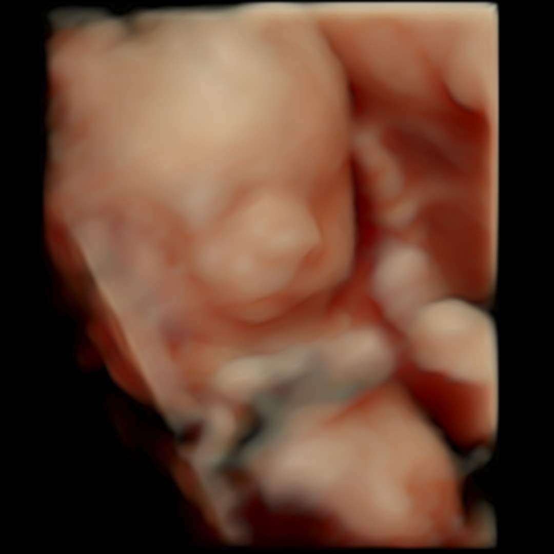Photo shared by Allie for their Babylist baby registry.