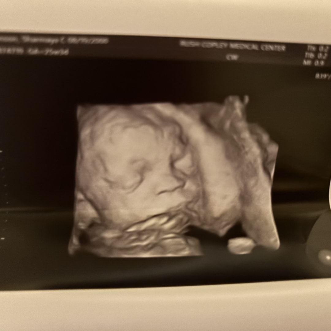 Photo shared by Sharmaya for their Babylist baby registry.