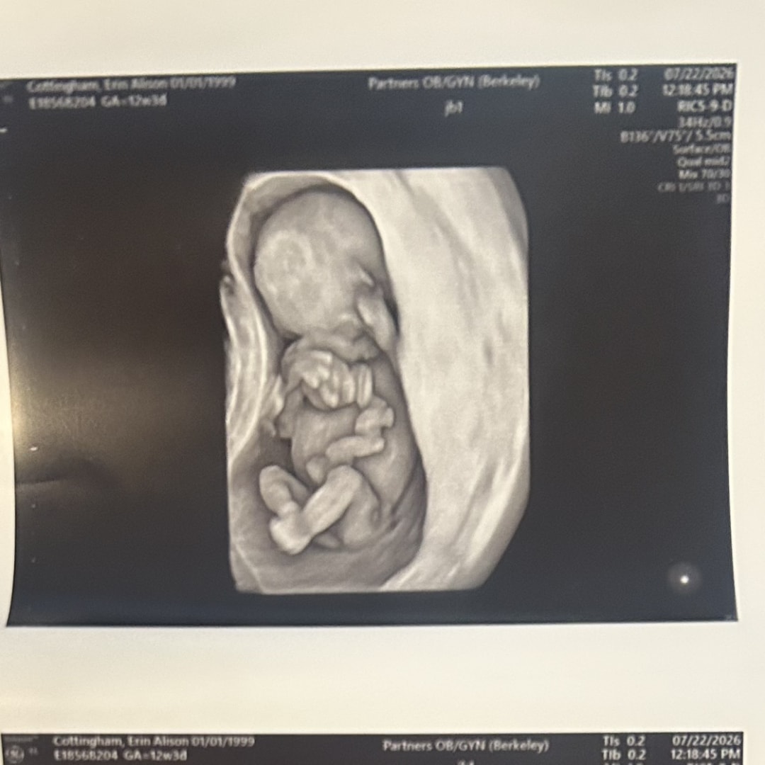 Photo shared by Erin for their Babylist baby registry.