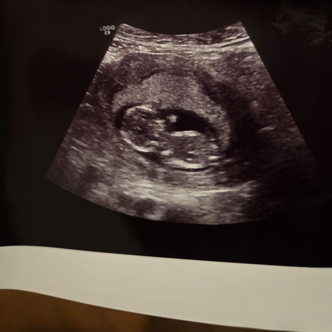 Photo shared by Alisha for their Babylist baby registry.