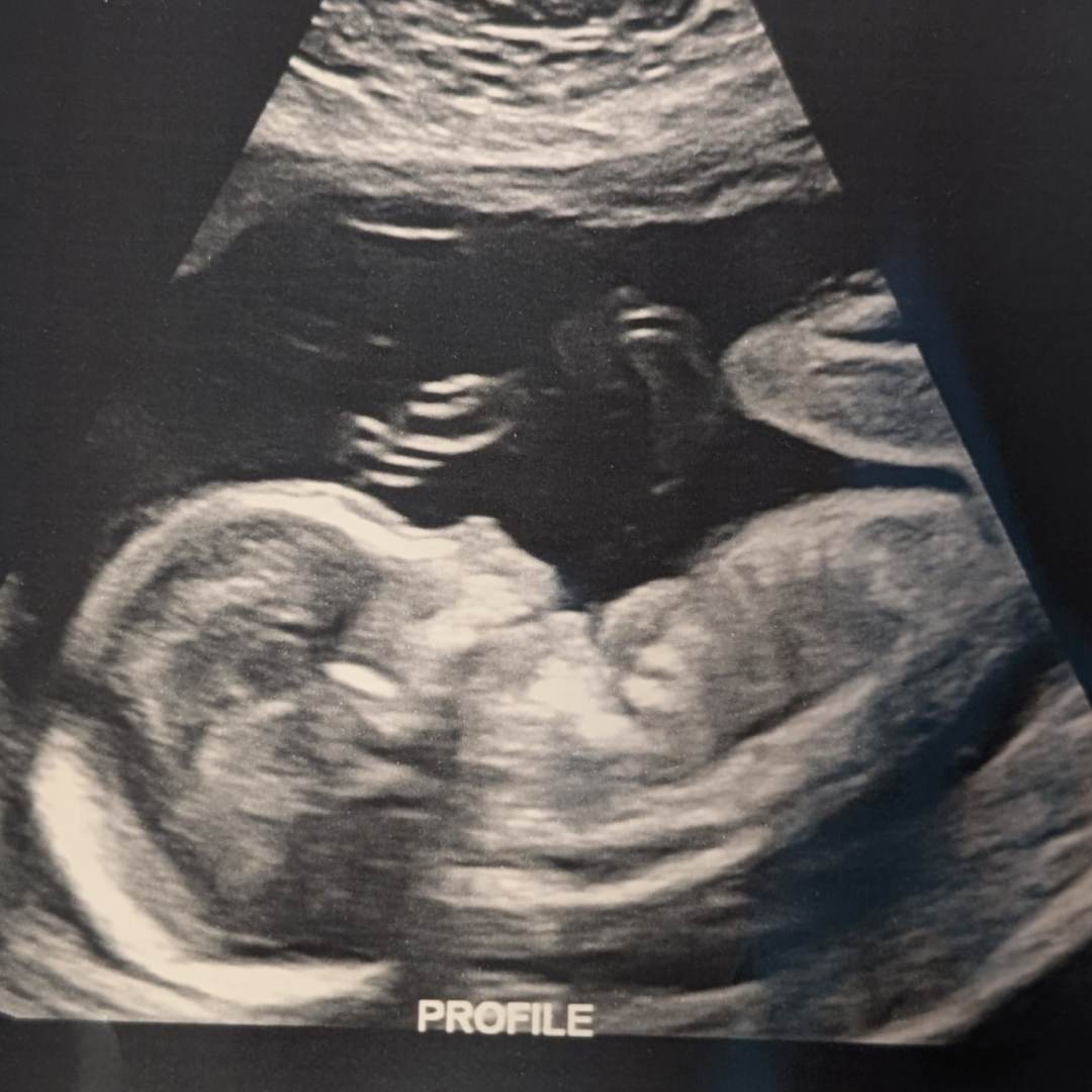 Photo shared by Cassidy for their Babylist baby registry.