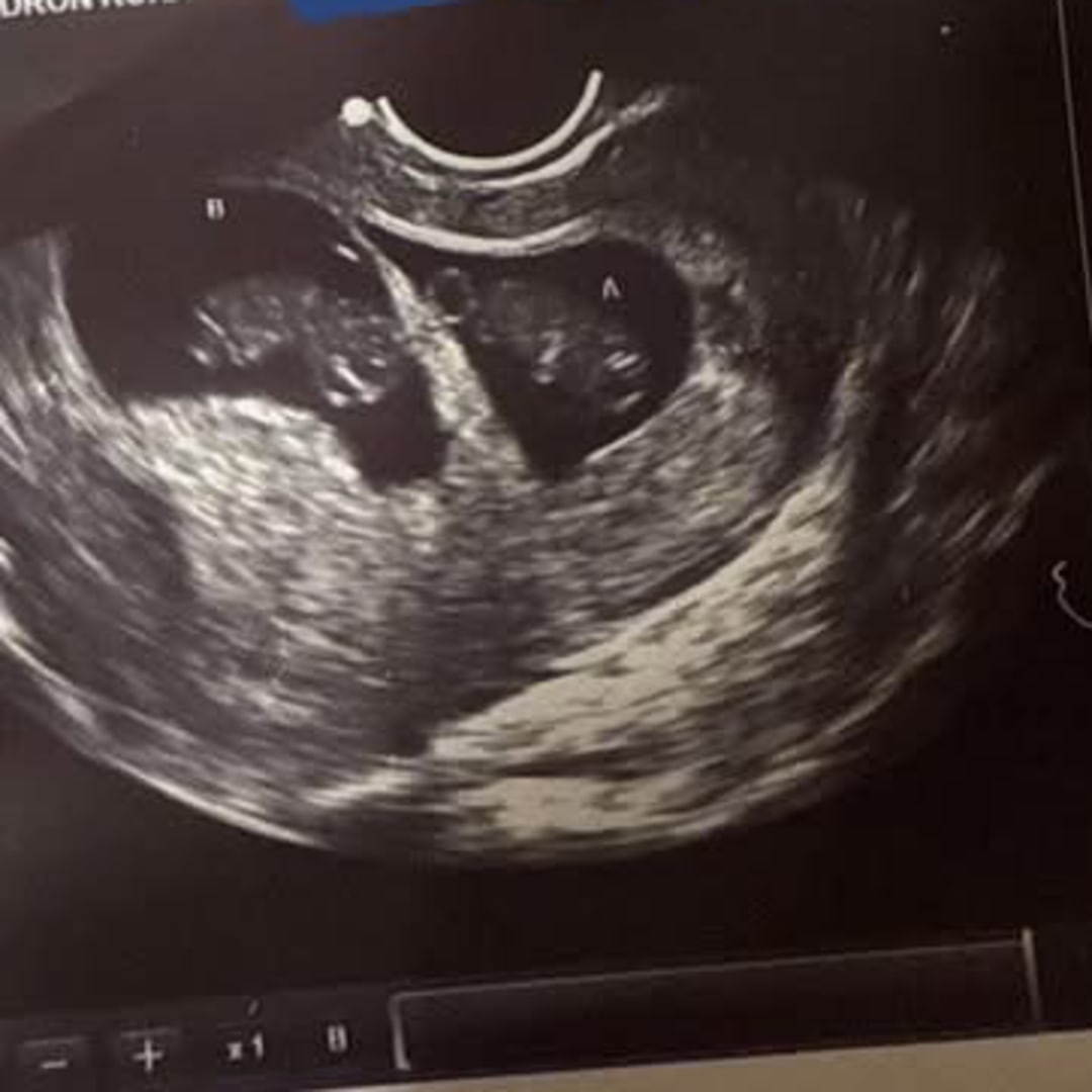 Photo shared by Kora for their Babylist baby registry.