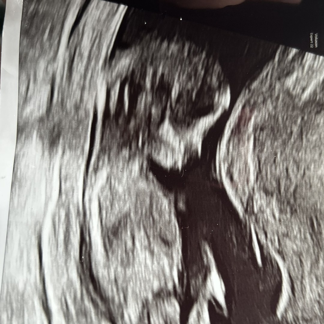 Photo shared by Melony for their Babylist baby registry.