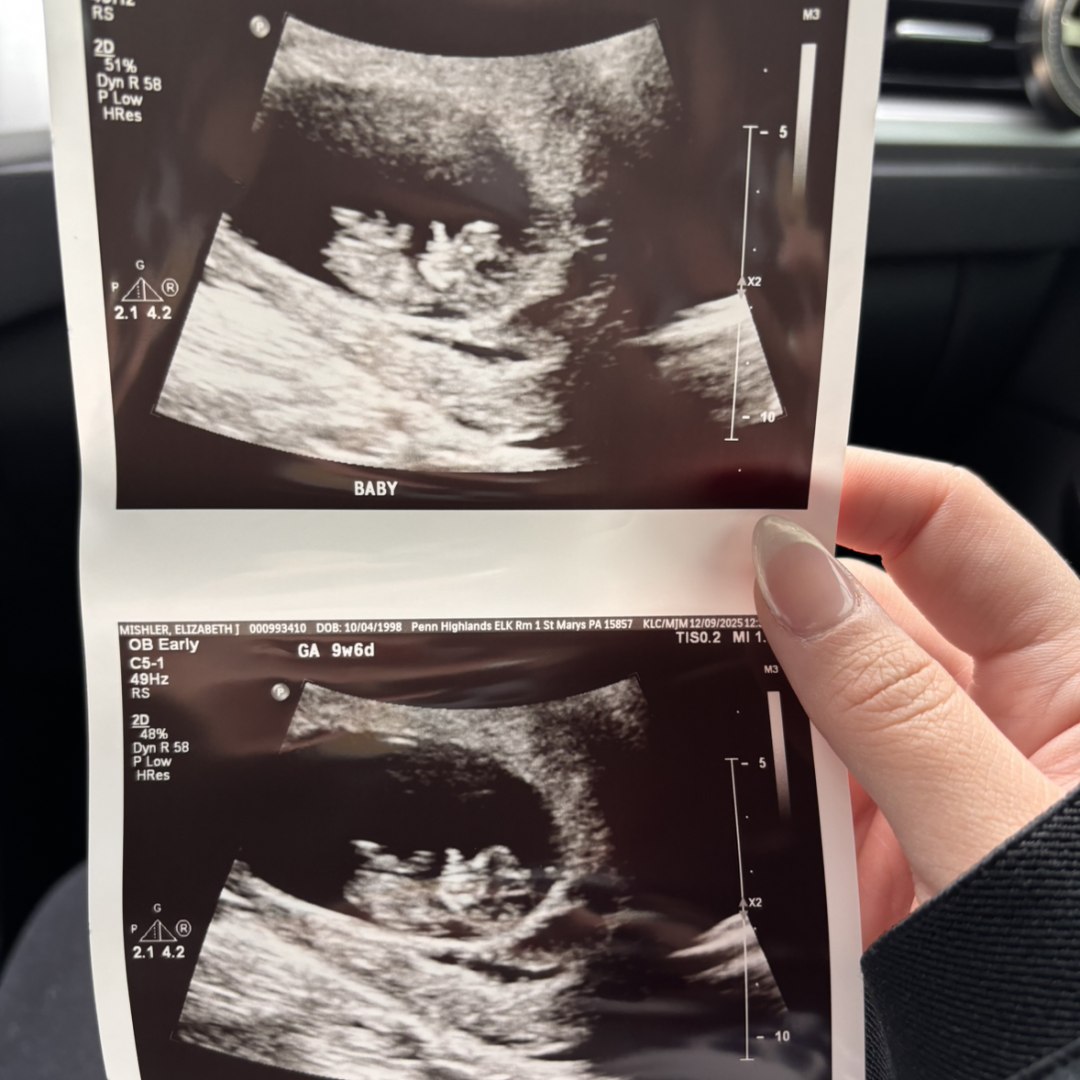 Photo shared by Elizabeth for their Babylist baby registry.