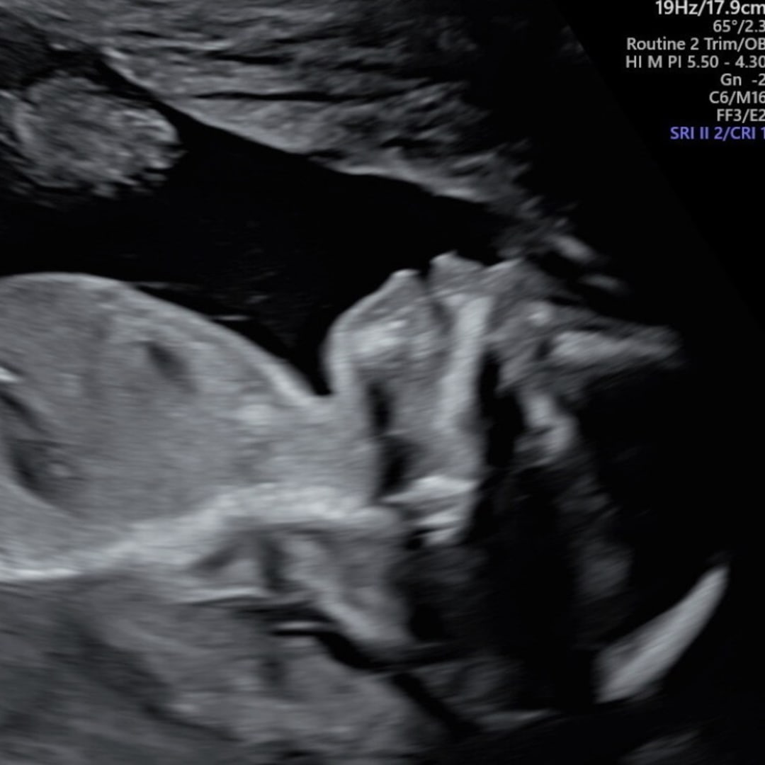 Photo shared by Forest for their Babylist baby registry.