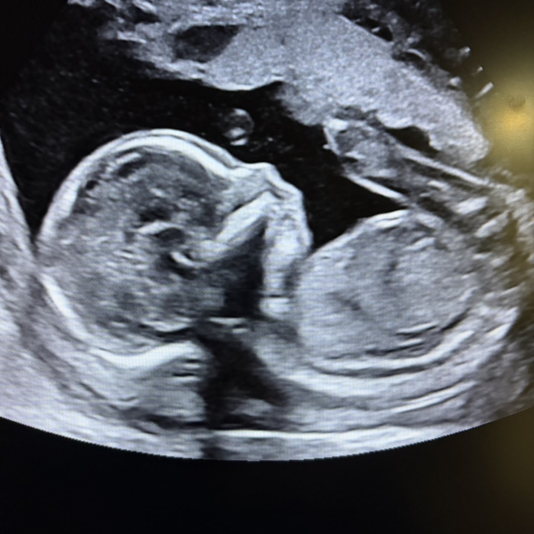 Photo shared by Kayleen for their Babylist baby registry.