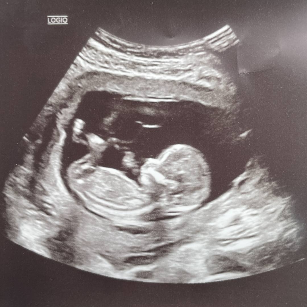 Photo shared by Hilda for their Babylist baby registry.
