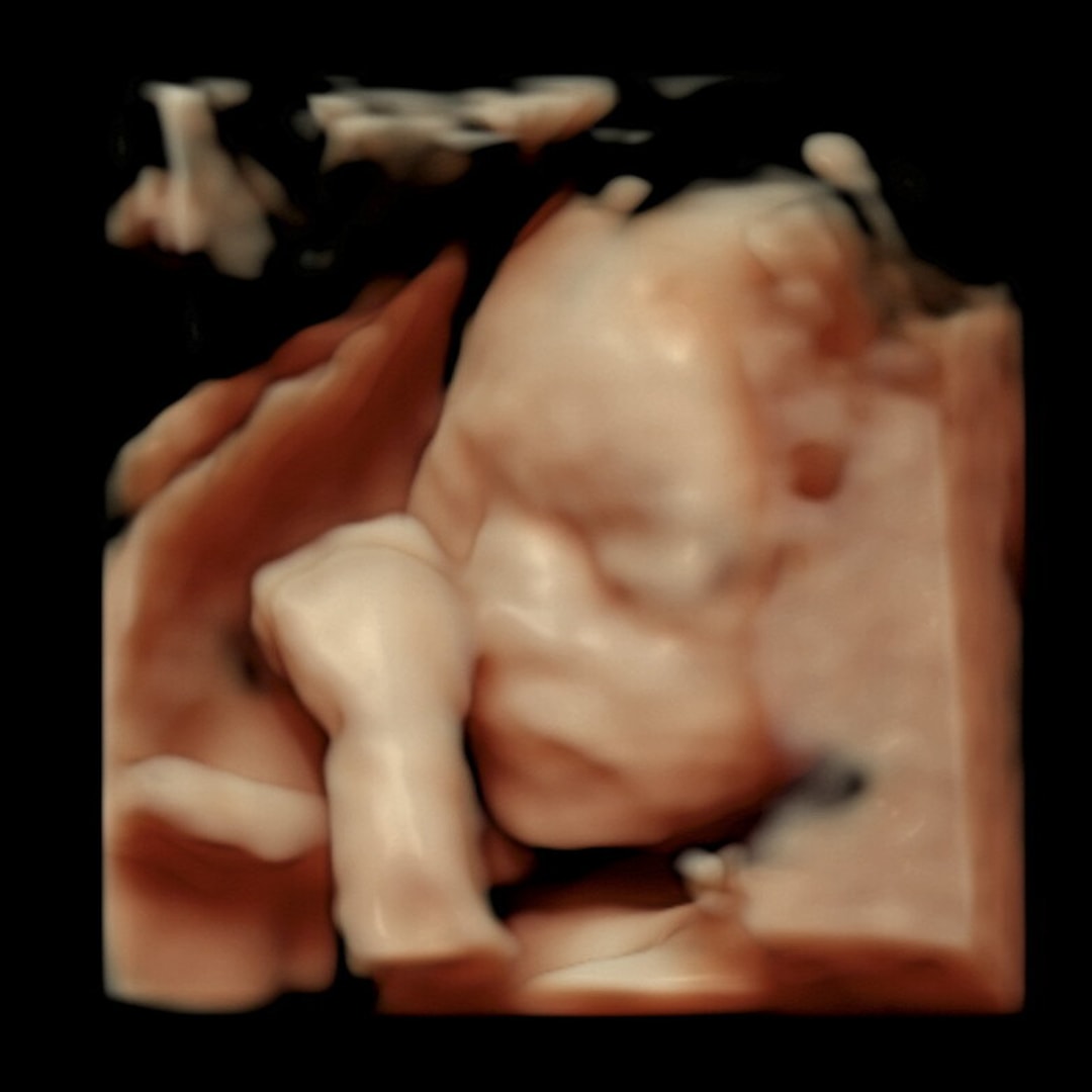 Photo shared by Sierra for their Babylist baby registry.