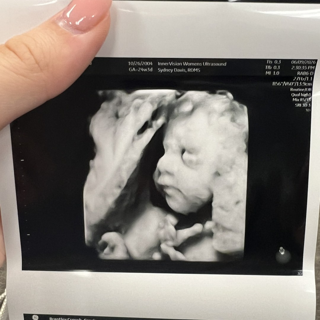 Photo shared by Gracie for their Babylist baby registry.