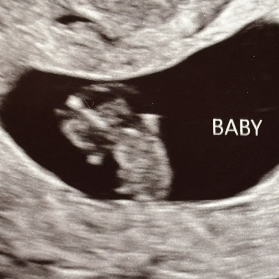 Photo shared by Autumn for their Babylist baby registry.