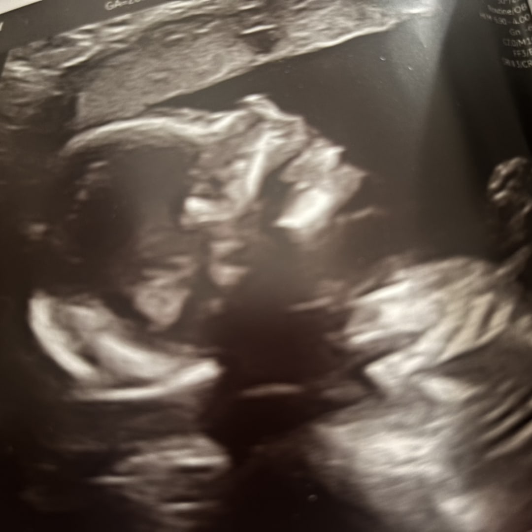 Photo shared by Nancy for their Babylist baby registry.