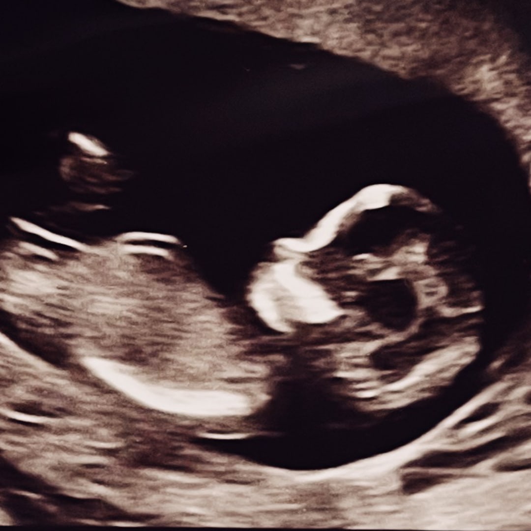 Photo shared by Isabella for their Babylist baby registry.