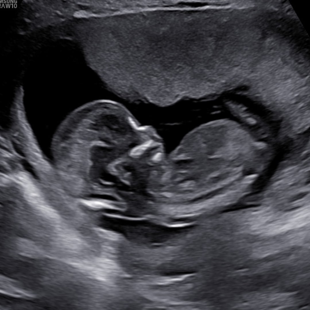 Photo shared by Karina for their Babylist baby registry.