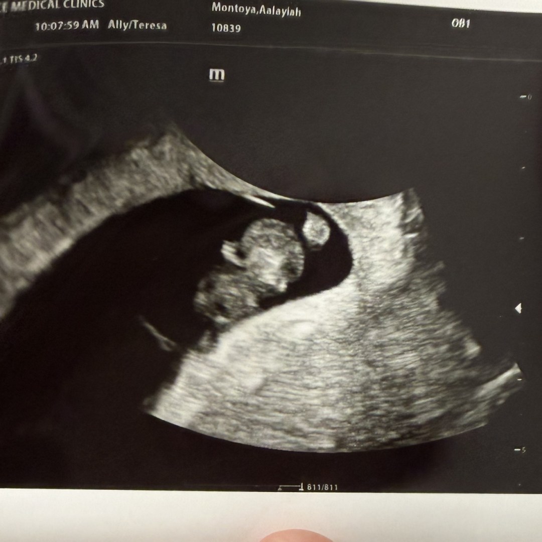 Photo shared by Alayiah for their Babylist baby registry.