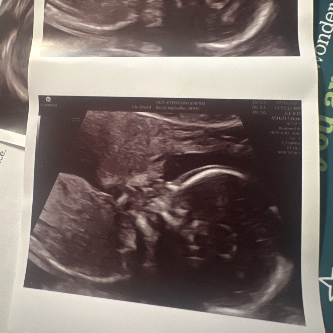 Photo shared by Alexis for their Babylist baby registry.