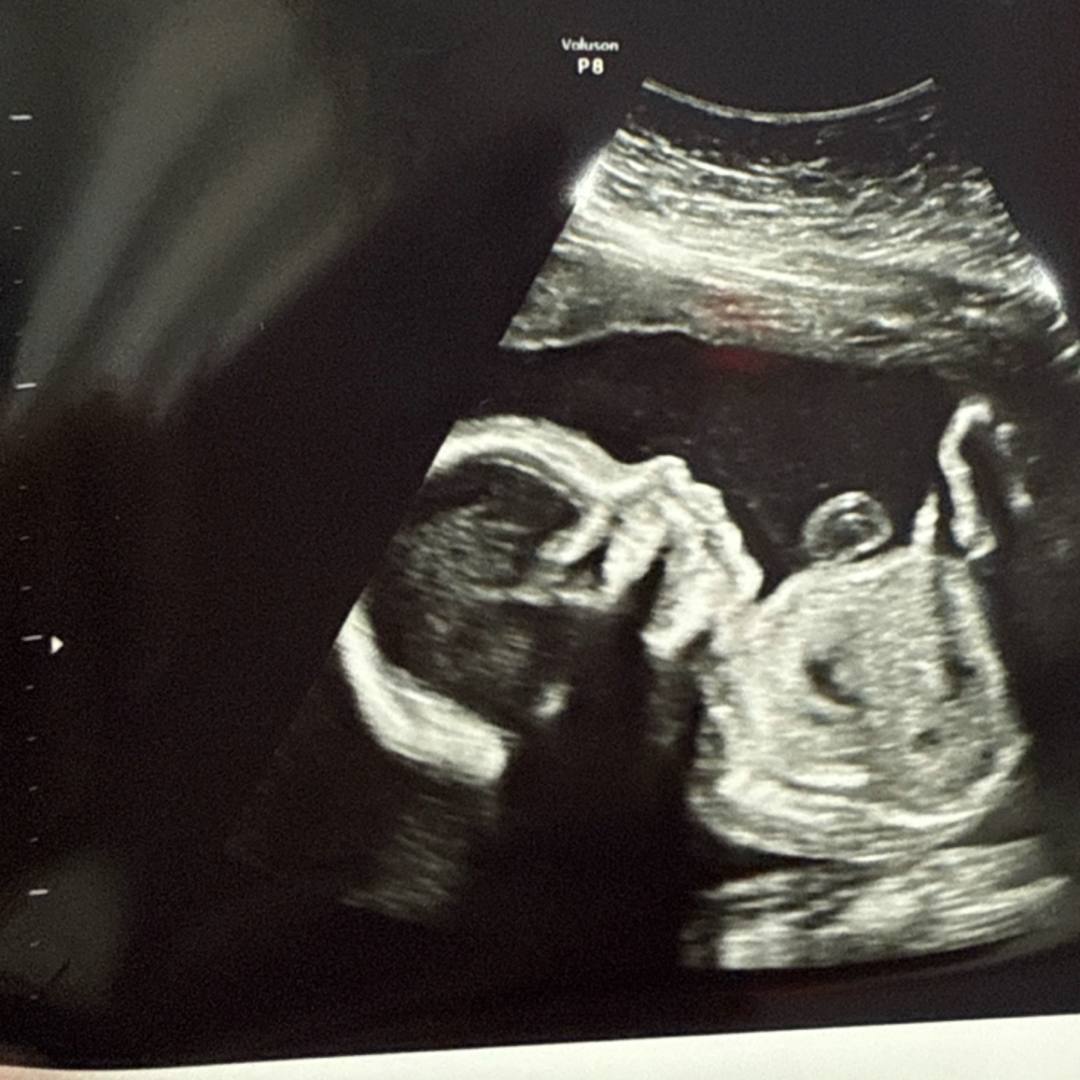 Photo shared by Desirea for their Babylist baby registry.