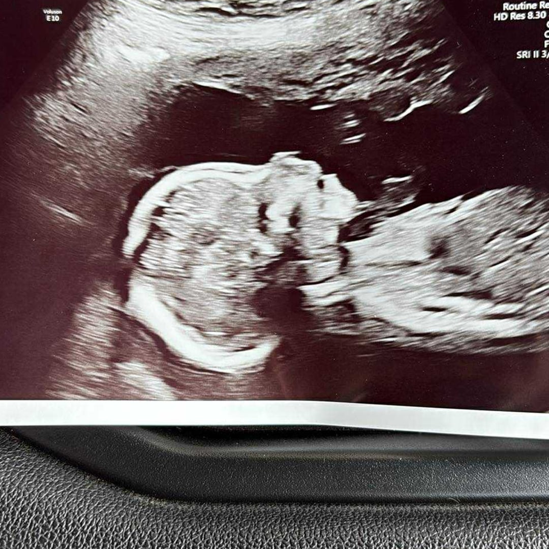 Photo shared by Caitlyn for their Babylist baby registry.