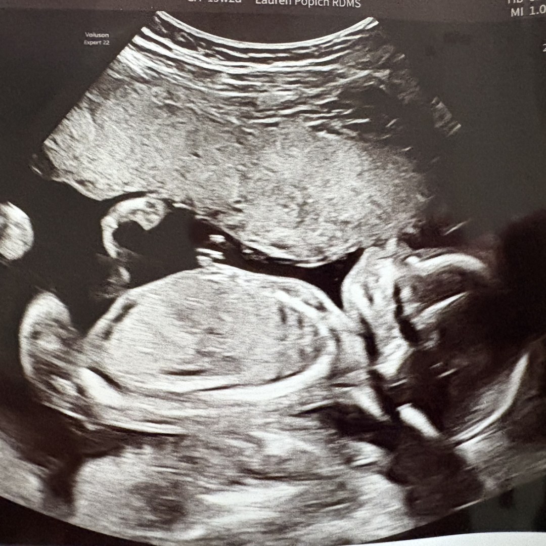 Photo shared by Tahmya for their Babylist baby registry.