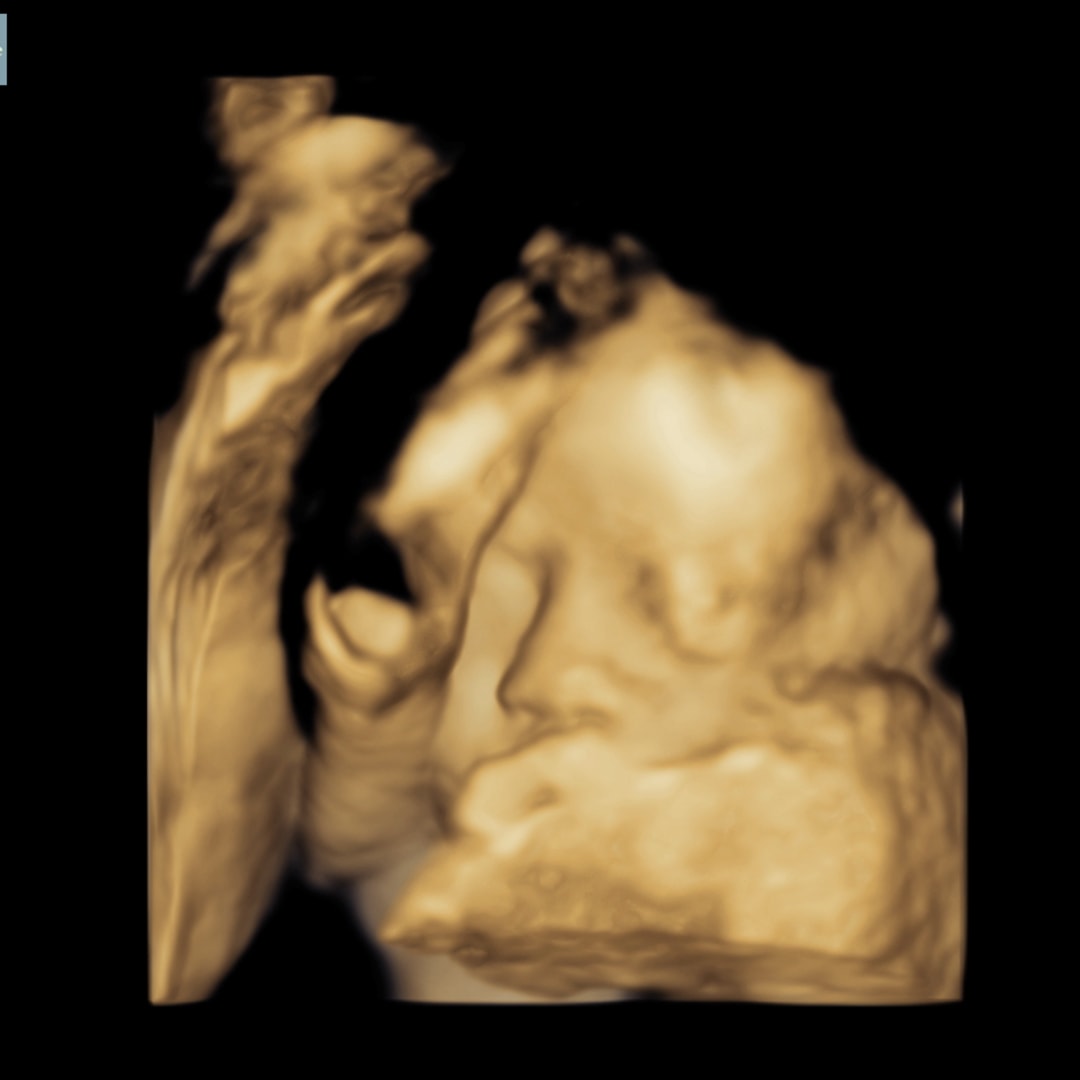 Photo shared by Kimberly for their Babylist baby registry.