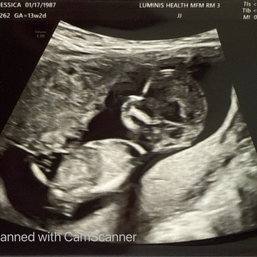 Photo shared by Jess for their Babylist baby registry.
