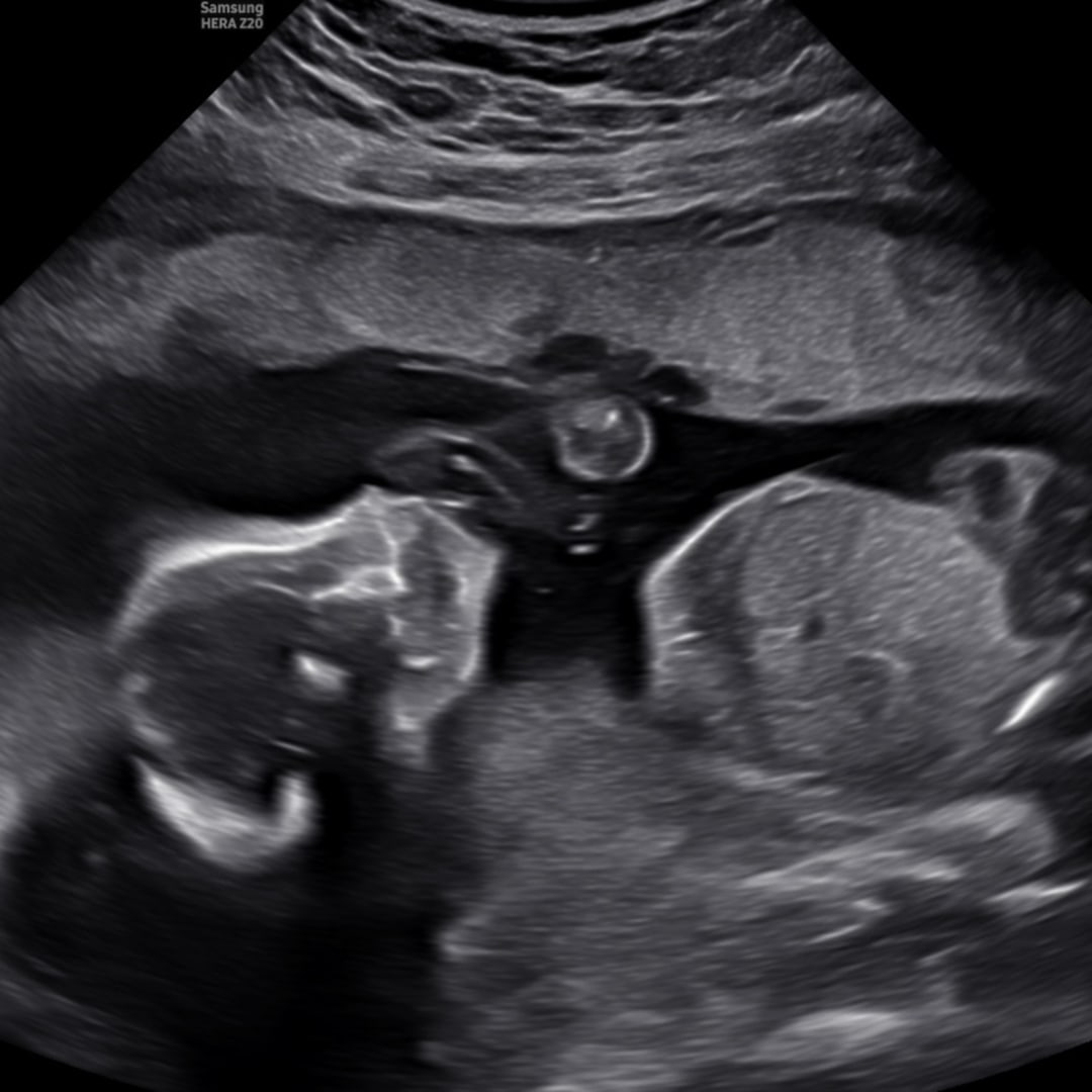 Photo shared by Brookelynn for their Babylist baby registry.