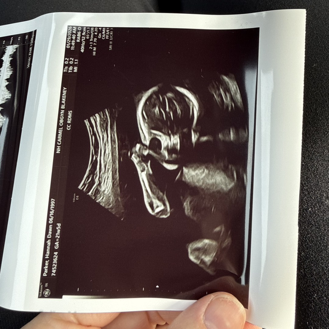 Photo shared by Hannah for their Babylist baby registry.