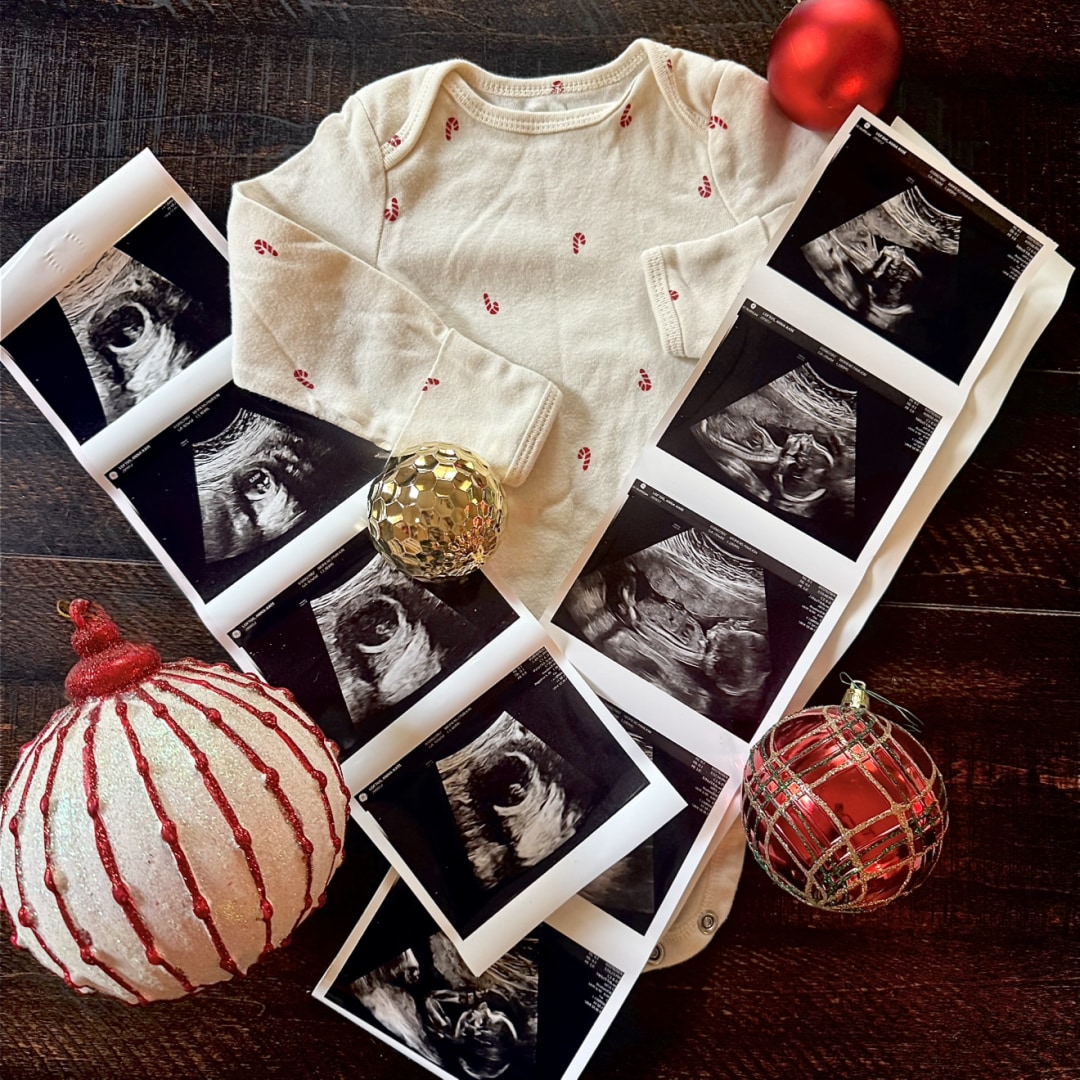 Photo shared by Anna-Kate for their Babylist baby registry.