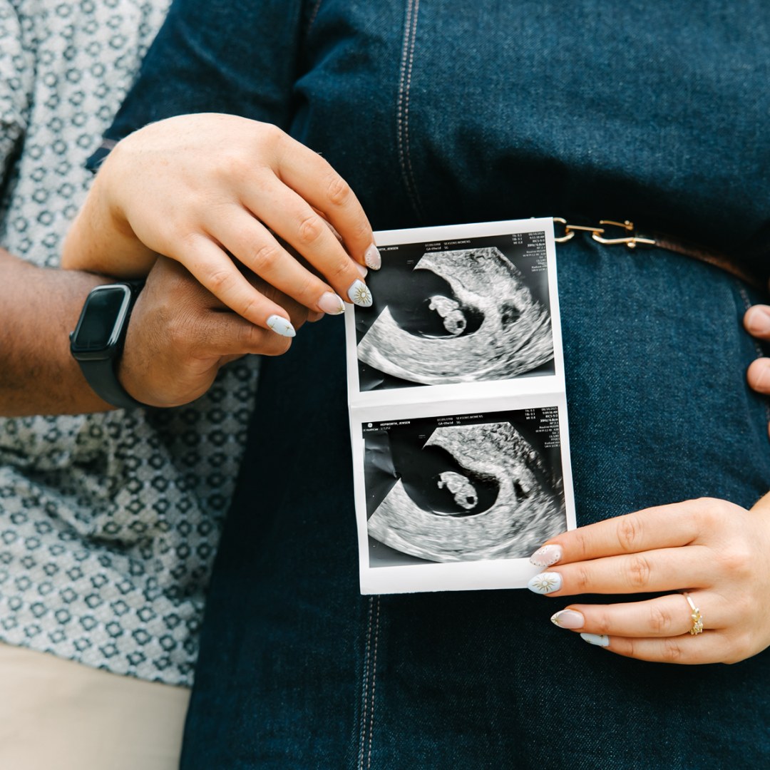 Photo shared by Jensen for their Babylist baby registry.