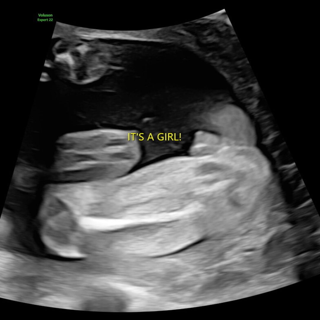 Photo shared by Keanah for their Babylist baby registry.