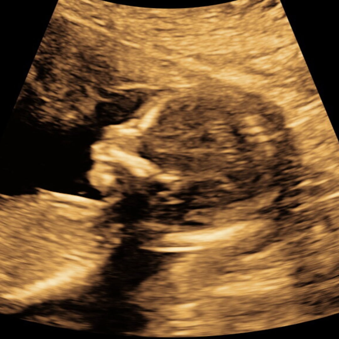 Photo shared by Gabriella for their Babylist baby registry.
