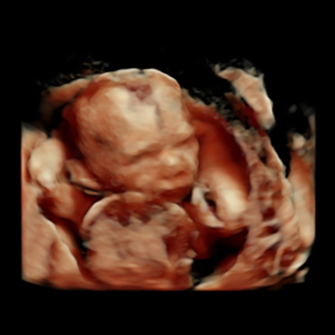 Photo shared by Haley for their Babylist baby registry.